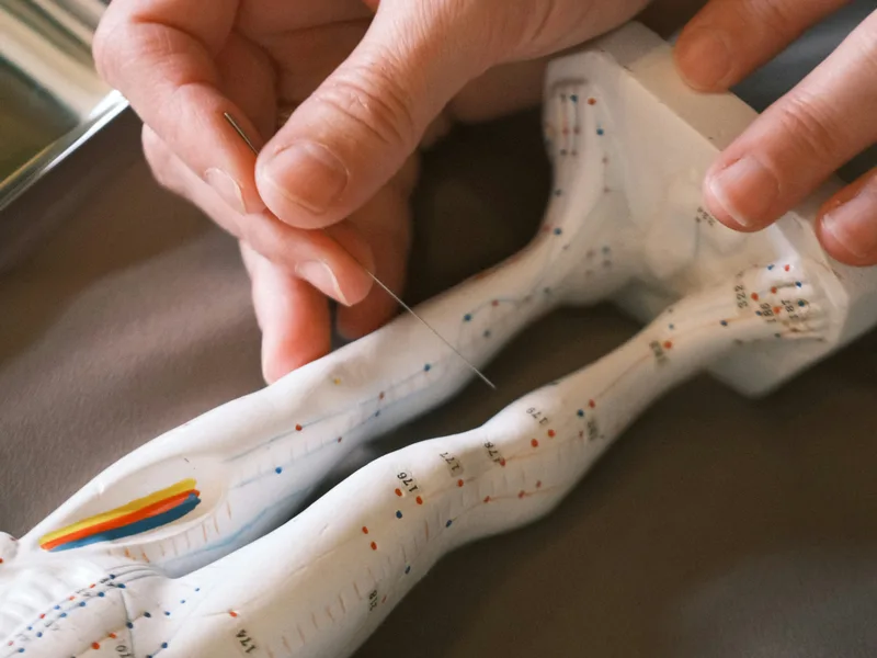 Acupuncture at Atnip Chiropractic in Owensboro
