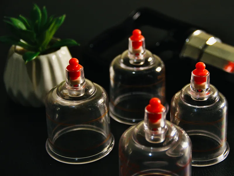 How Cupping Therapy works at Atnip Chiropractic