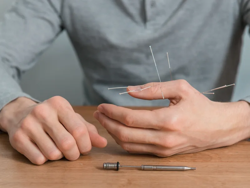 Dry Needling at Atnip Chiropractic in Owensboro