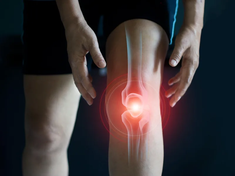 How Atnip Chiropractic treats arthritis in Owensboro